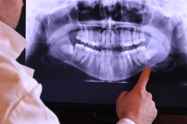 Best Weekend Emergency Dentist in North Barrington, IL