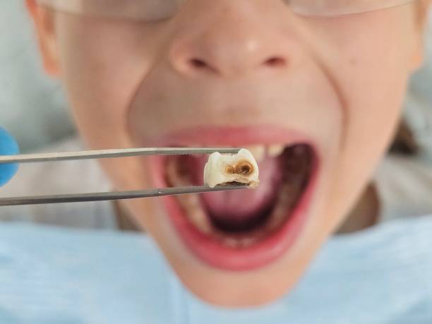 Best Pediatric Emergency Dentist in North Barrington, IL